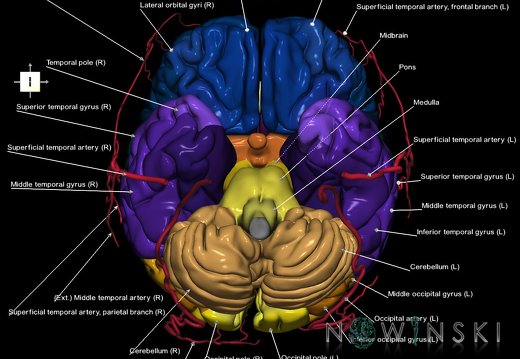 G2.T2-17.2.V6.C3-2.L1.Brain–Extracranial arteries