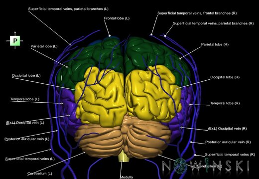 G2.T2-18.2.V3.C2.L1.Brain–Extracranial veins