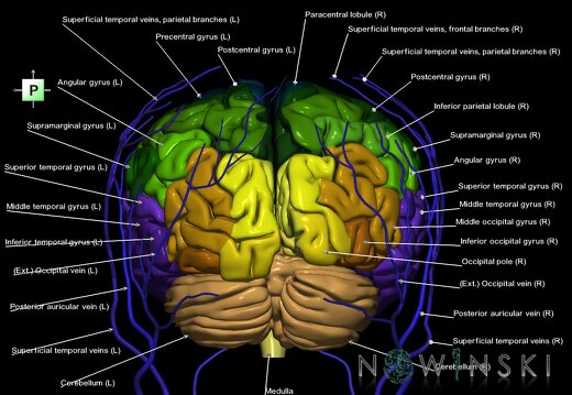 G2.T2-18.2.V3.C3-2.L1.Brain–Extracranial veins