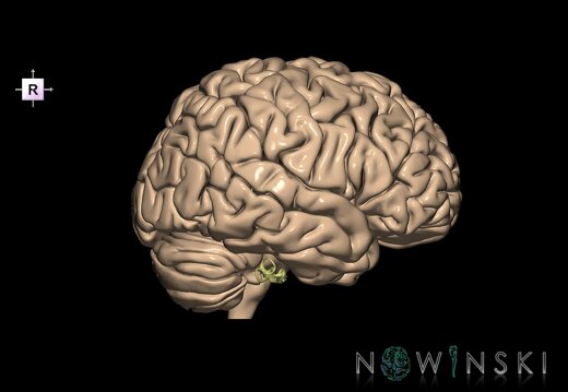 G2.T2-25.V4.C1.L0.Brain–Auditory system