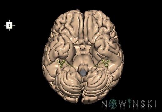 G2.T2-25.V6.C1.L0.Brain–Auditory system