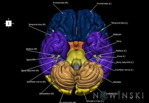 G2.T2-25.V6.C2.L1.Brain–Auditory system