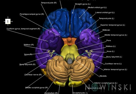 G2T2-25.Brain AuditorySystem