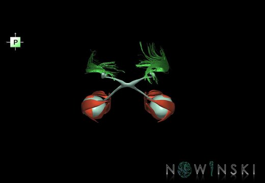G2.T20.4-26.V3.C1.L0.Extraocular muscles–Visual system