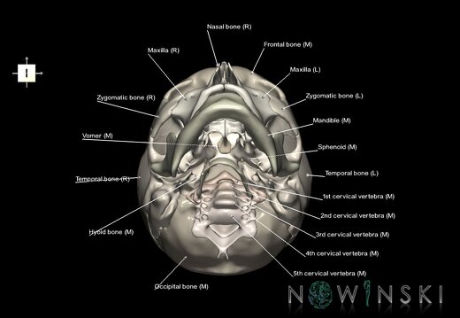 G2.T22.1-23.V6.C2.L1.Skull whole–Cervical spine