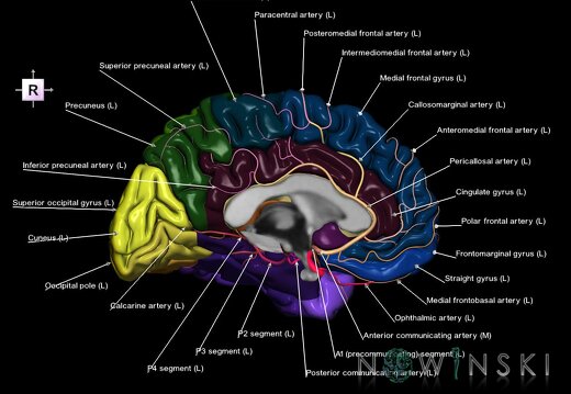 G2T3.2-15.3.CerebrumLeft-IntracranialArterialSystemLeft