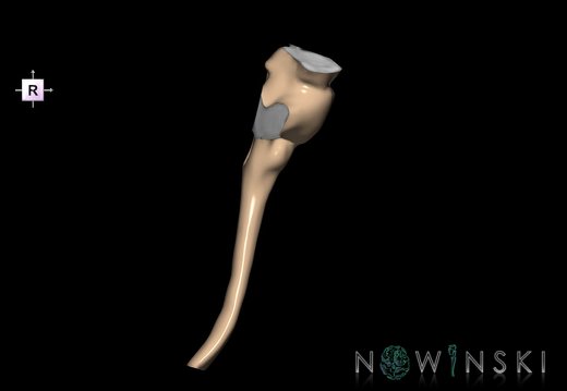 G2.T9-10.V4.C1.L0.Brainstem-Cervical spinal cord