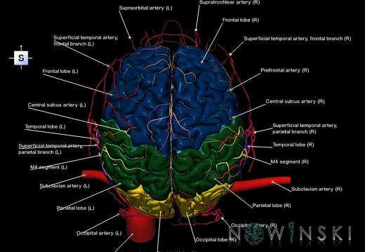 G3.T1.1-15.2-17.2.V5.C2.L1.CNS–Intracranial arteries–Extracranial arteries