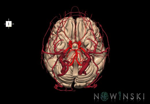 G3.T1.1-15.2-17.2.V6.C1.L0.CNS–Intracranial arteries–Extracranial arteries