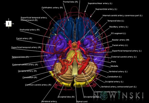 G3.T1.1-15.2-17.2.V6.C2.L1.CNS–Intracranial arteries–Extracranial arteries