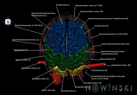 G3.T1.1-17.2-19.1.V5.C2.L1.CNS–Extracranial arteries–Cranial nerves