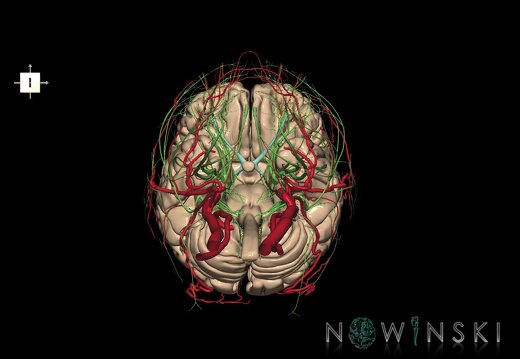 G3.T1.1-17.2-19.1.V6.C1.L0.CNS–Extracranial arteries–Cranial nerves