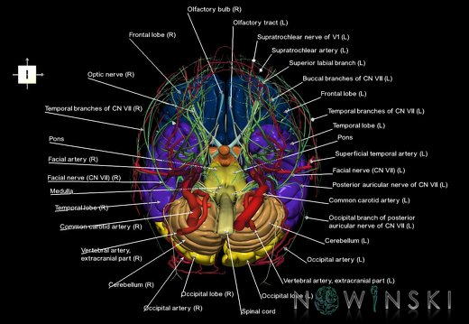 G3.T1.1-17.2-19.1.V6.C2.L1.CNS–Extracranial arteries–Cranial nerves