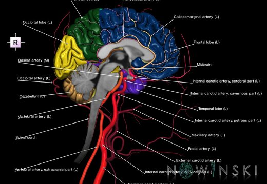 G3.T1.2-15.3-17.3.V4.C2.L1.CNS–Intracranial arteries–Extracranial arteries.Left