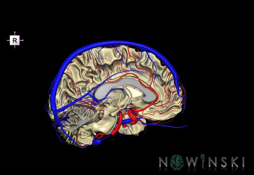 G3.T13.2-15.3-16.2.V4.C1.L0.White matter–Intracranial arteries–Intracranial venous system.Left