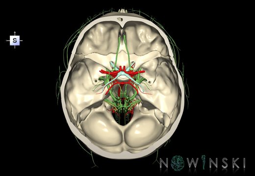 G3.T15.1-19.1-22.3.V5.C1.L0.Intracranial arteries–Cranial nerves–Skull base