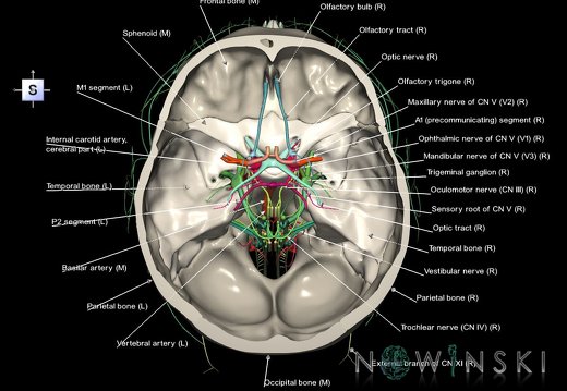 G3.T15.1-19.1-22.3.V5.C2.L1.Intracranial arteries–Cranial nerves–Skull base