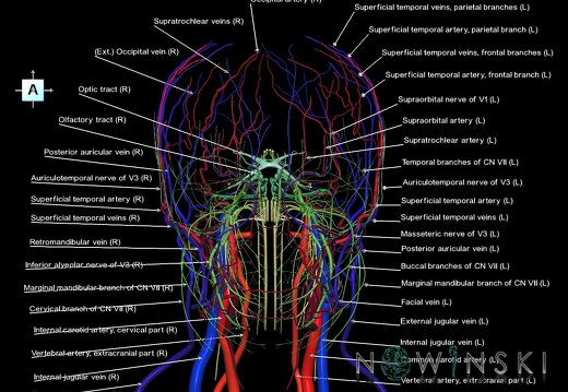 G3T17.2-18.2-19.1.ExtracranialArteries-ExtracranialVeins-CranialNerves