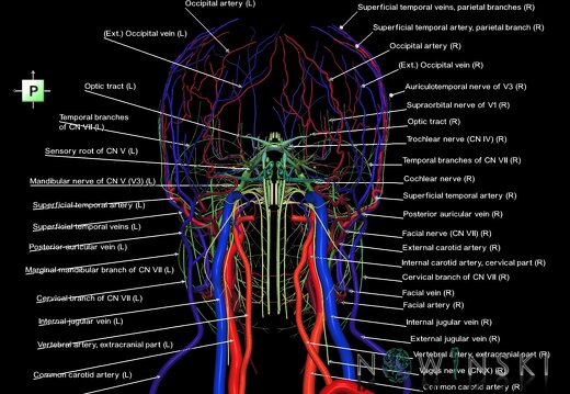 G3.T17.2-18.2-19.1.V3.C2.L1.Extracranial arteries–Extracranial veins–Cranial nerves