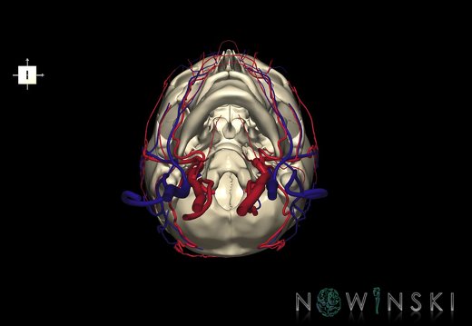 G3.T17.2-18.2-22.1.V6.C1.L0.Extracranial arteries–Extracranial veins–Skull