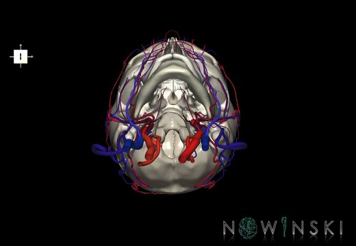 G3.T17.2-18.2-22.1.V6.C2.L0.Extracranial arteries–Extracranial veins–Skull