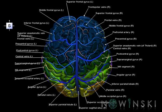 G3.T2.1-15.2-16.1.V5.C3-2-2.L1.Brain–Intracranial arteries–Intracranial venous system