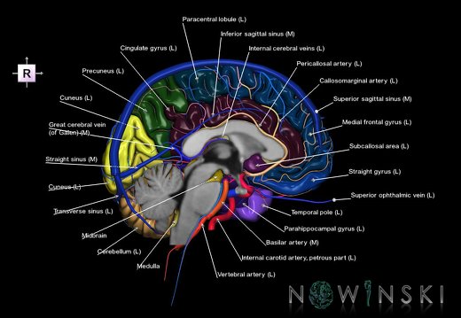 G3.T2.2-15.3-16.2.V4.C3-2-2.L1.Brain–Intracranial arteries–Intracranial venous system.Left