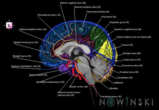 G3.T2.3-15.4-16.3.V2.C3-2-2.L1.Brain–Intracranial arteries–Intracranial venous system.Right