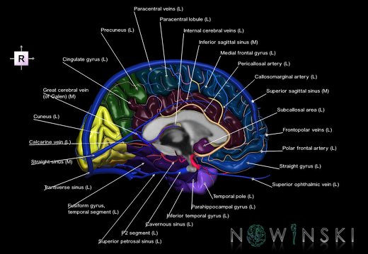 G3.T3.2-15.3-16.2.V4.C3-2-2.L1.Cerebrum–Intracranial arteries–Intracranial venous system.Left