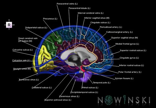 G3.T3.2-15.3-16.2.V4.C4-2-2.L1.Cerebrum–Intracranial arteries–Intracranial venous system.Left