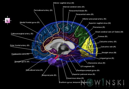 G3.T3.3-15.4-16.3.V2.C3-2-2.L1.Cerebrum–Intracranial arteries–Intracranial venous system.Right