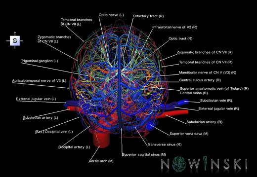 G4.T15.2-16.1-17.2-18.2-19.1.V5.C2.L1.Intracranial arterial–venous systems–Extracranial arteries–veins–Cranial nerves