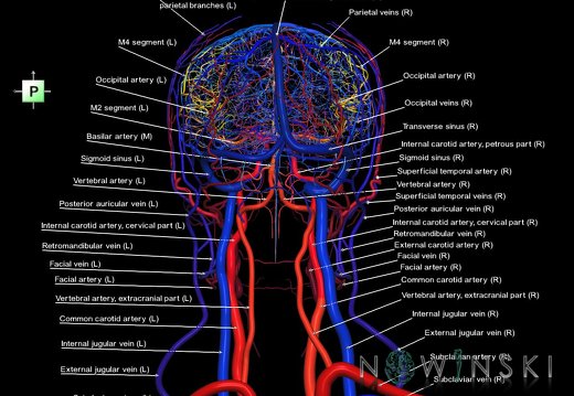 G4.T15.2-16.1.-17.2-18.2.V3.C2.L1.Intracranial arteries–Intracranial venous system–Extracranial arteries–Extracranial veins