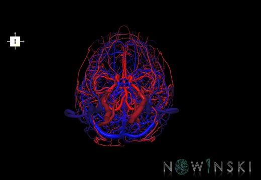 G4.T15.2-16.1.-17.2-18.2.V6.C1.L0.Intracranial arteries–Intracranial venous system–Extracranial arteries–Extracranial veins