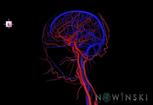 G4.T15.4-16.3.-17.4-18.4.V2.C1.L0.Intracranial arterial–venous systems–Extracranial arteries–veins.Right