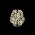 G5.T10-9-11-12-13-8.V5.C2.L0.Spinal cord––White matter–Cerebellum