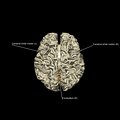 G5.T10-9-11-12-13-8.V5.C2.L1.Spinal cord––White matter–Cerebellum