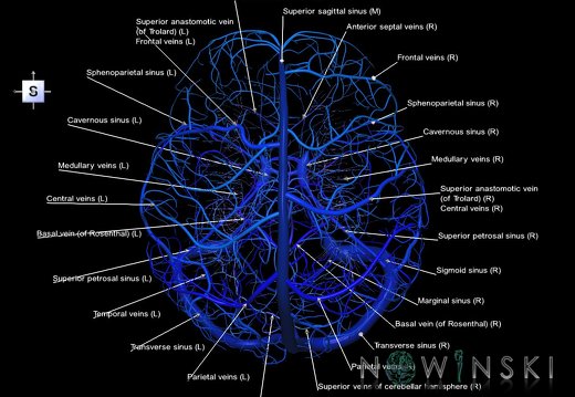 G5.T16.4-16.7-16.6-16.5.V5.C2.L1.Dural sinuses–Posterior fossa veins–Deep veins–Superficial veins