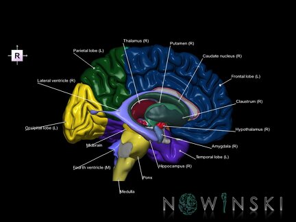 G5.T9-11-12-3.2.V4.C2.L1.Brainstem–Deep nuclei–Ventricles–Cerebrum left