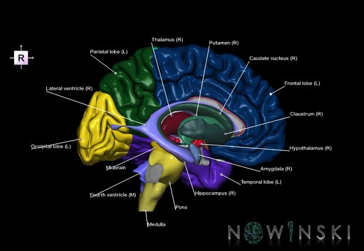 G5.T9-11-12-3.2.V4.C2.L1.Brainstem–Deep nuclei–Ventricles–Cerebrum left