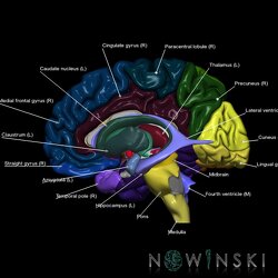 G5.T9-11-12-3.3.V2.C2--3.L1.Brainstem–Deep nuclei–Ventricles–Cerebrum right