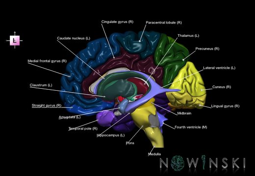 G5.T9-11-12-3.3.V2.C2--3.L1.Brainstem–Deep nuclei–Ventricles–Cerebrum right