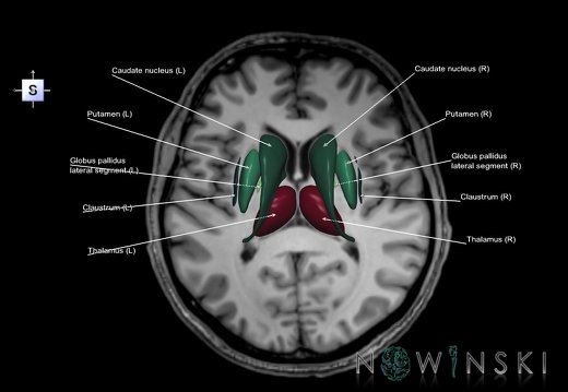 G6T11.DeepNuclei–Triplanar