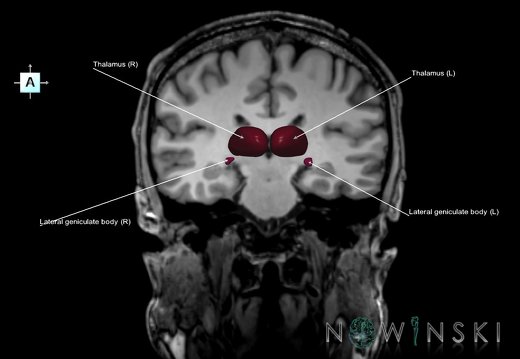 G6T11.11.Thalamus–Triplanar