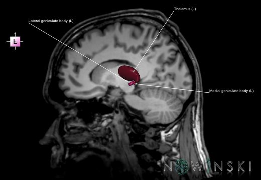 G6.T11.11.V2.P13S.Thalamus–Triplanar