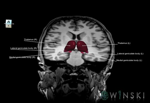 G6.T11.11.V7.P14.-27S.Thalamus–Triplanar