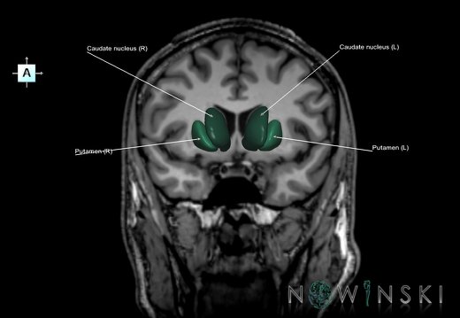 G6.T11.4.V1.P05S.Corpus striatum–Triplanar