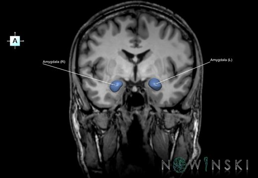 G6T11.7.Amygdala–Triplanar