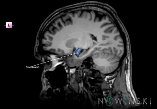 G6.T11.7.V2.P23S.Amygdala–Triplanar