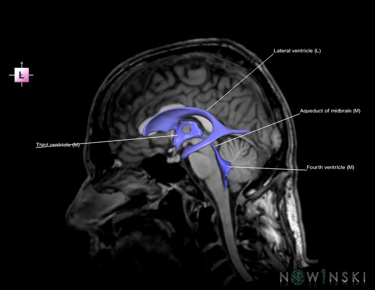 G6.T12.V2.P00S.Cerebral_ventricles–Triplanar.tiff